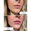 Afbeelding van Eye of Love - Matchmaker Kiss Chemistry Lip Gloss - Pink Pulse
