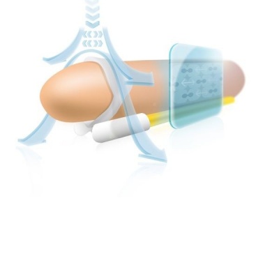 Andropenis Mini Penis Extender - image 6